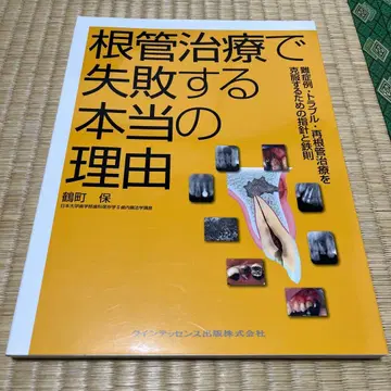 근관 치료 실패의 진짜 이유 츠루마치 타모츠