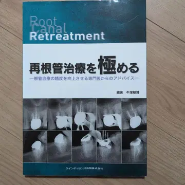 재근관 치료를 극찬하다: 근관 치료의 정확도를 향상시키는 전문가의 조언