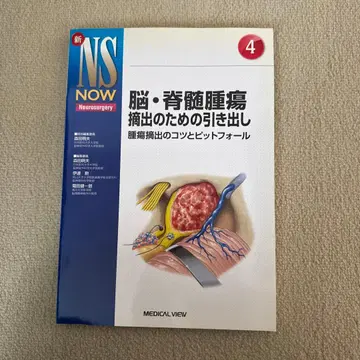 뇌 척수종양 적출을 위한 서랍 종양 적출의 요령과 함정