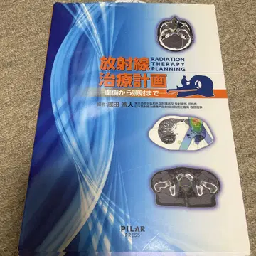 방사선 치료 계획