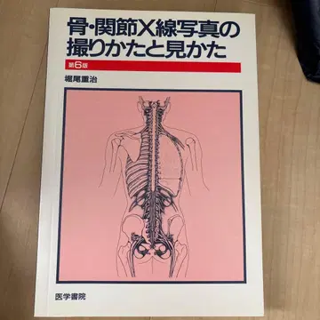 골 관절 X선 사진 촬영법과 판독법