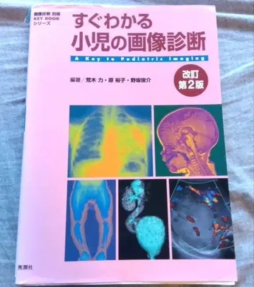 바로 이해하는 소아 영상 진단