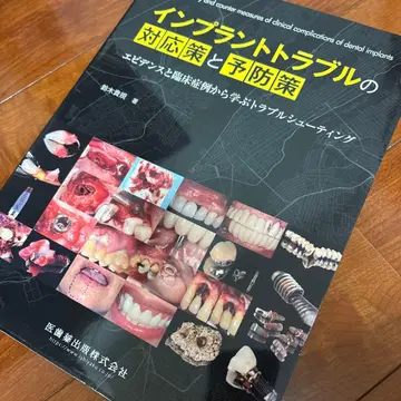 임플란트 트러블의 대응책과 예방책