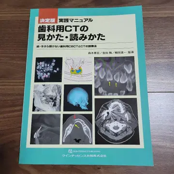결정판 실천 매뉴얼 치과용 CT의 보는 법 읽는 법