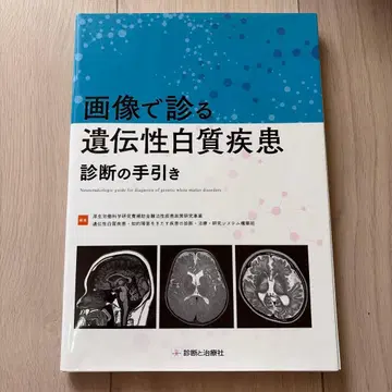 [재단 완료] 이미지로 보는 유전성 백질 질환 진단 가이드