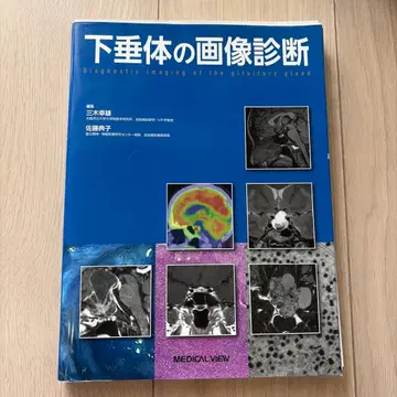 [재단 완료] 뇌하수체 영상 진단