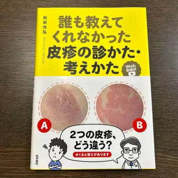 아무도 알려주지 않았던 피부 발진의 진찰법과 사고법