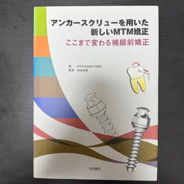 닻 스크류를 이용한 새로운 MTM 교정