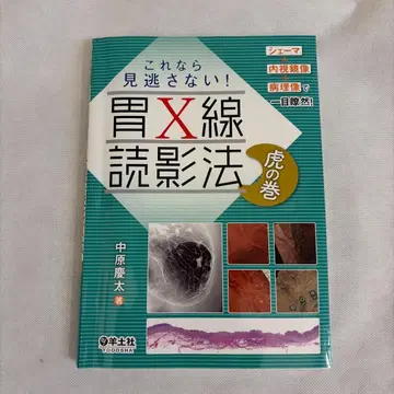 위 X선 판독법 호랑이 족보 나카하라 케이타 양토사