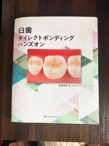 일치 다이렉트 본딩 핸즈온 (재단 완료)