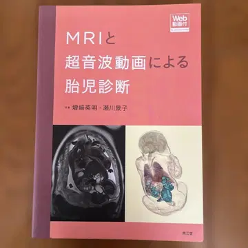 MRI와 초음파 동영상에 의한 태아 진단 [Web 동영상 포함]