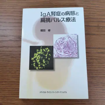 IgA 신증의 병태와 편도 적출 펄스 요법