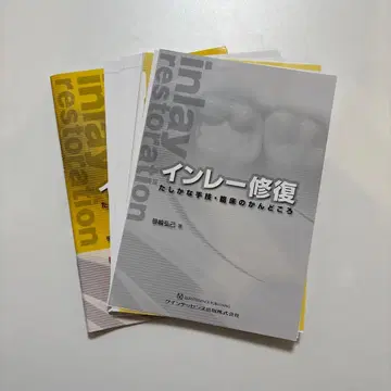 [ 재단 완료 ] 인레이 복원 확실한 수기 임상의 핵심