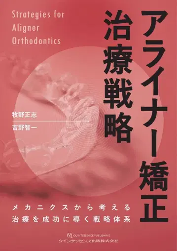 얼라이너 교정 치료 전략 재단 완료