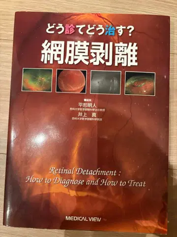 어떻게 진단하고 어떻게 치료할까? 망막 박리