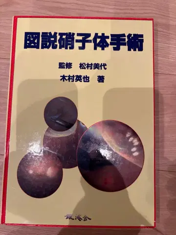 도설 유리체 수술