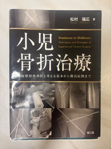 소아 골절 치료 기술과 전략