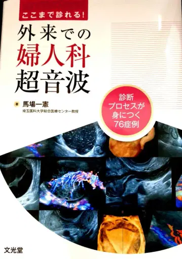 [재단 완료] 여기까지 진료 가능! 외래 부인과 초음파