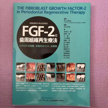 FGF-2와 치주 조직 재생 치료