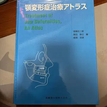 턱 변형증 치료 아틀라스