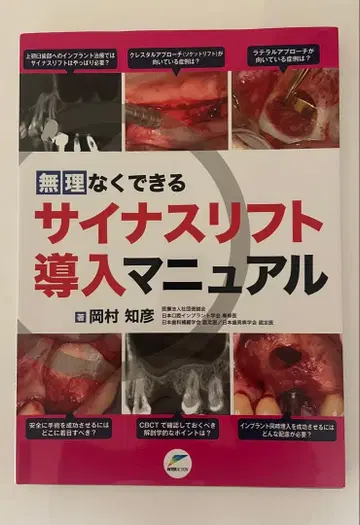 무리 없이 할 수 있는 사이너스 리프트 도입 매뉴얼