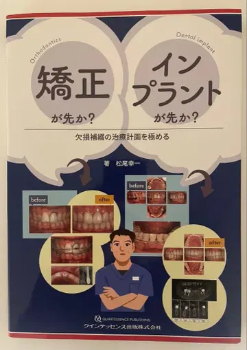 교정이 먼저일까? 임플란트가 먼저일까?