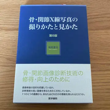 골 관절 X선 사진의 촬영 방법과 보는 법