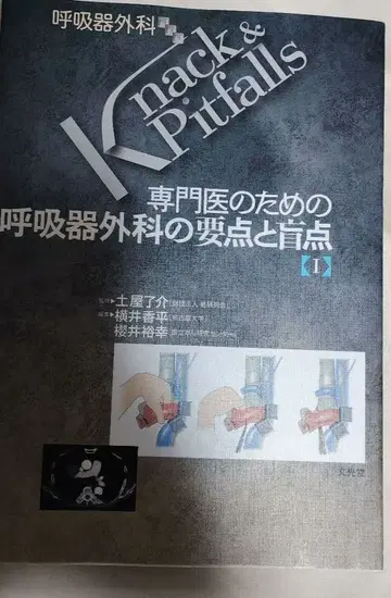 Knack & Pitfalls 호흡기 외과의 요점과 맹점 [1]