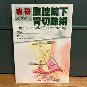 복강경 위 절제술 간켄 스타일