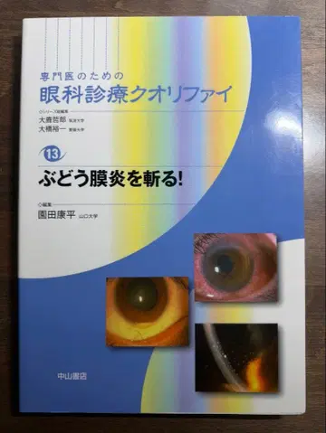 안과 진료 퀄리파이 포도막염을 베다!