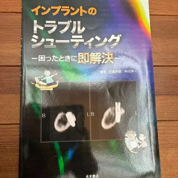 임플란트 트러블 슈팅 - 곤란할 때 즉시 해결