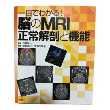 한눈에 알 수 있다! 뇌의 MRI 정상 해부와 기능