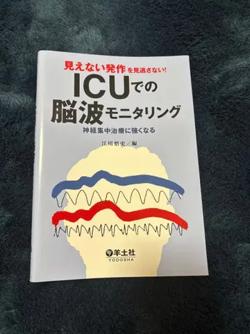 보이지 않는 발작을 놓치지 마세요! ICU에서의 뇌파 모니터링 [절단됨]