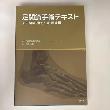 발목 관절 수술 텍스트 인공 관절 골절술 고정술