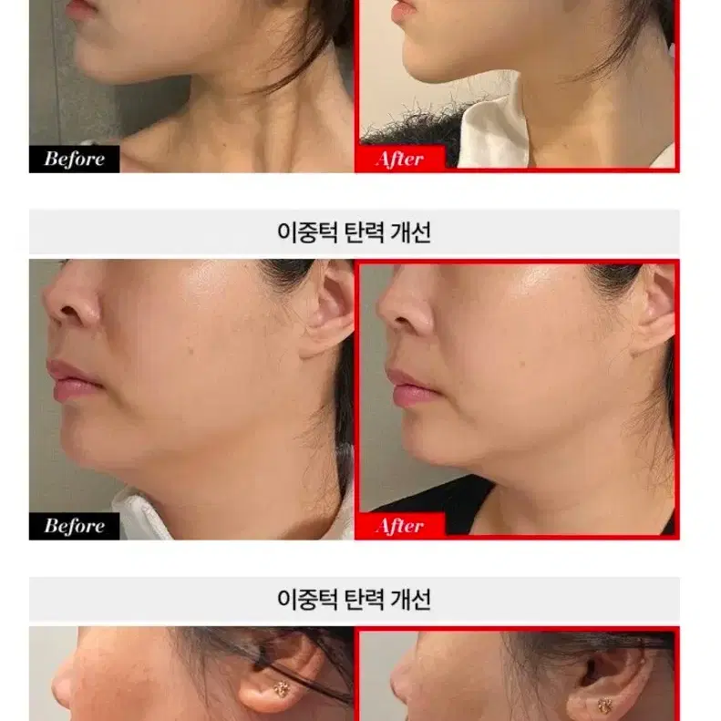 대용량 수분 물광 모공 탄력 8종 국민화잘먹크림 앙투아네셀 허니스킨 크림