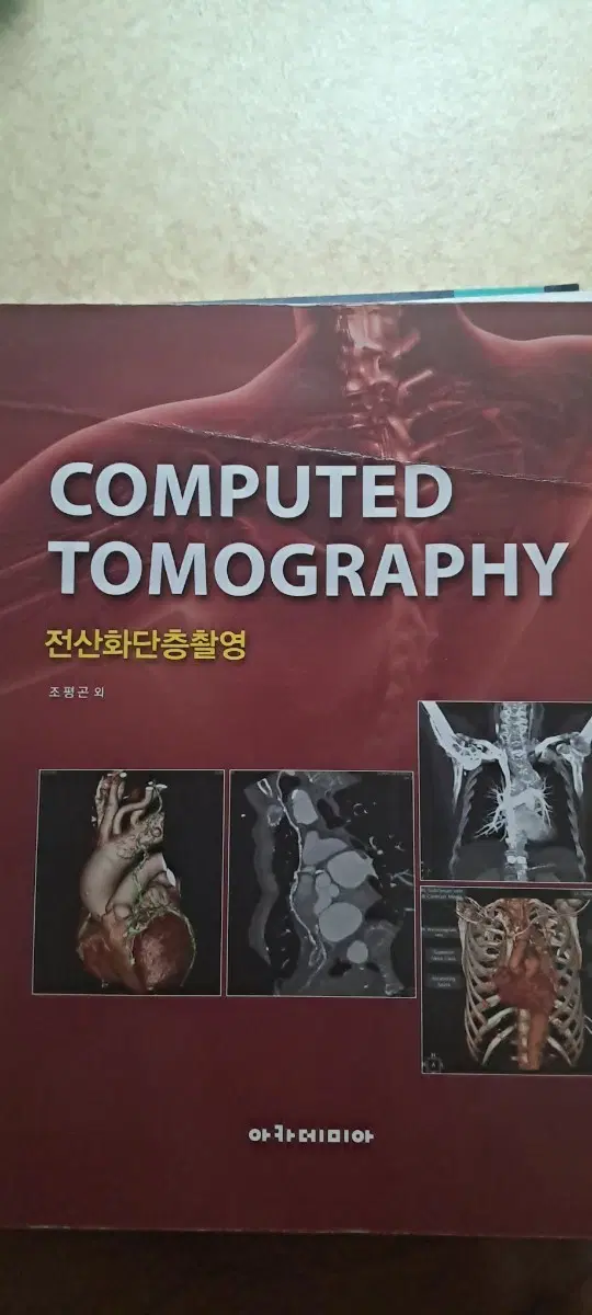 COMPUTED TOMOGRAPHY 전산화단층촬영