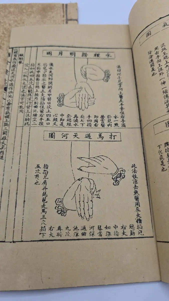 추나광의 석인본 한의학 의서 전3권
