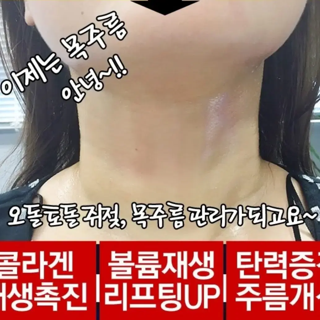 청담동샵 품절대란/메디필 나이테 실 넥크림/목주름 리프팅 화장품