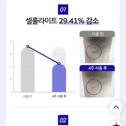 셀룰라이트 붓기 관리 메디테라피 속살스핀